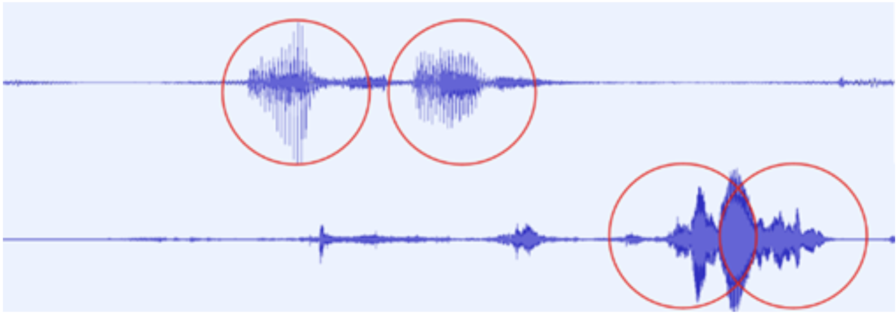 Waveform image showing sysarthric speech has more diffuse regions than non-disordered speech